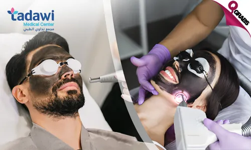 Glow & Renew: Spectra Bleaching, Carbon Laser & Fractional Laser!